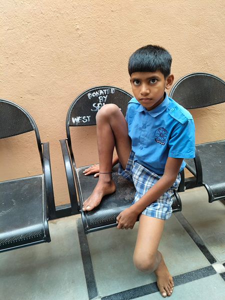 Ranveer After Treatment