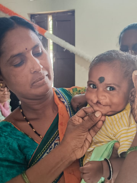 Aira Before Corrective Surgery