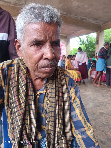 Cataract Case Before Surgery