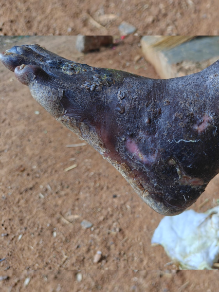 Killana Satyam Post-Recovery Healing