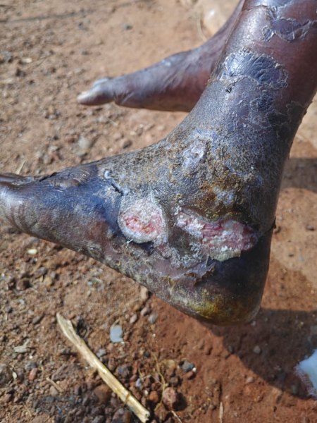 Killana Satyam Before Doorstep Care